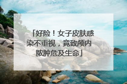好险！女子皮肤感染不重视，竟致颅内脓肿危及生命